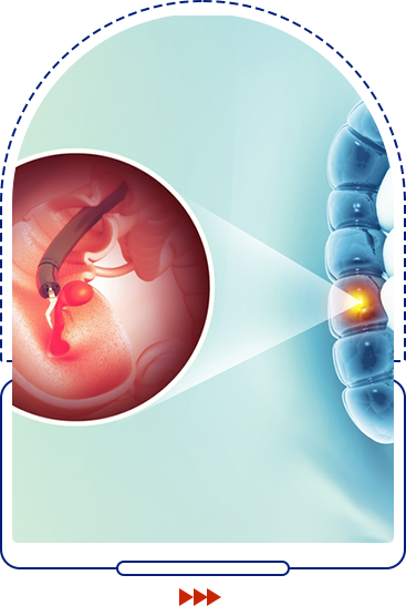 Colonoscopy icon