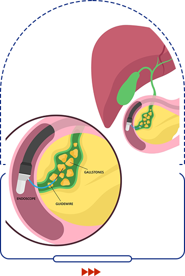 ERCP icon