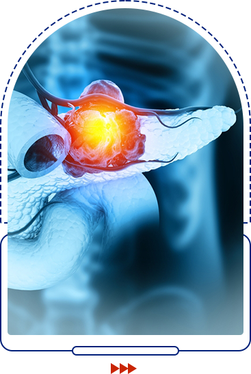 Pancreatitis icon